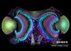 2010最佳生物显微摄影：中国《野花种子》进前十