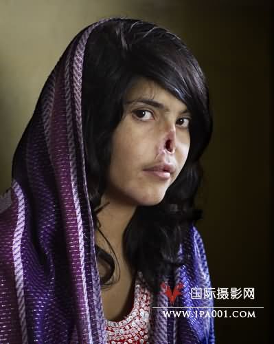 南非摄影师Jodi Bieber拍摄的《阿富汗割鼻少女》获年度图片奖