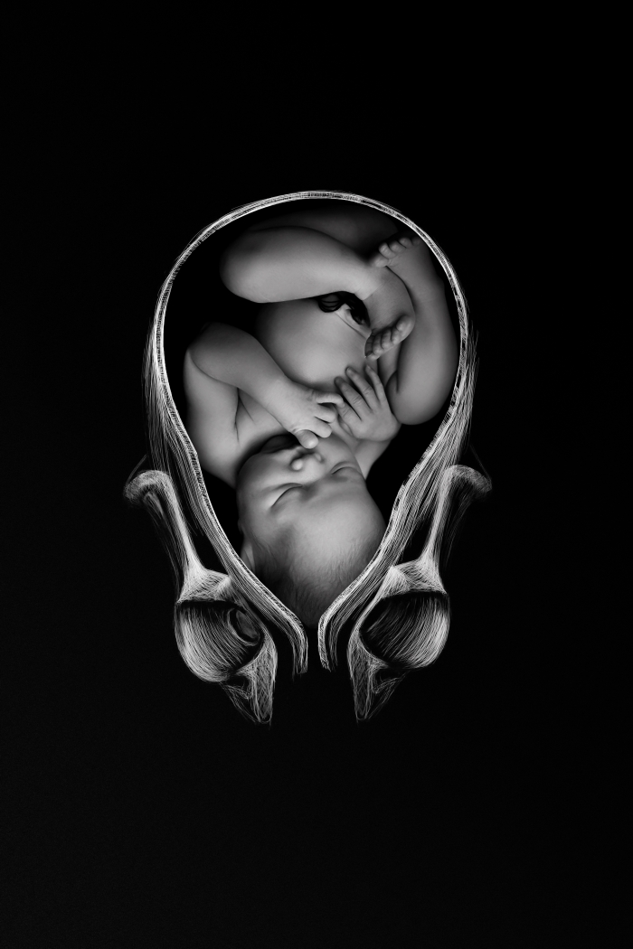 images